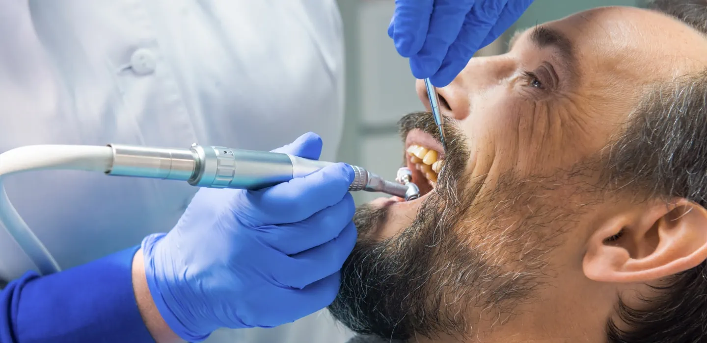 Zahnarzt reinigt die verfärbten Zähne eines Mannes